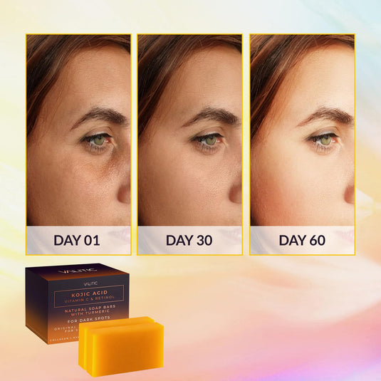 Kojic Acid Vitamin C and Retinol Soap